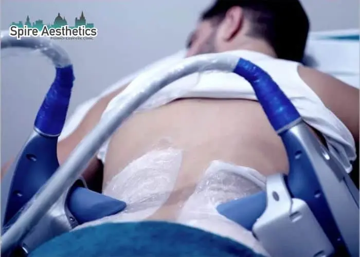 Man having fat freezing treatment done on love handles before a competitions East Grinstead to create a sculpted look.